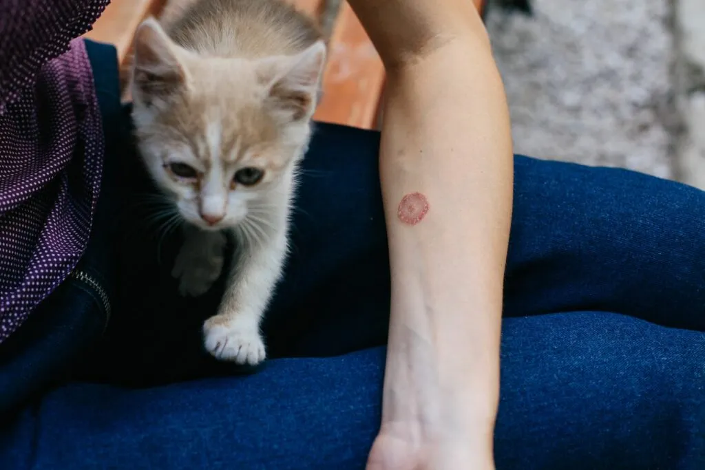 donna ha contratto tigna dal gatto sul braccio